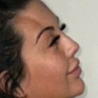 Chlofans Desnuda