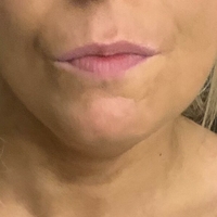 Holytits Desnuda