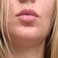 Laurie_Berlin Desnuda