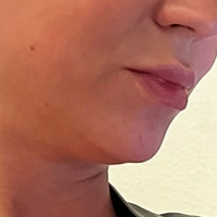 misslobatox Desnuda