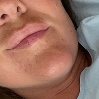 naughty_katarina_free Desnuda