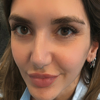 patena24free Desnuda