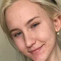 Trippi Miki Desnuda